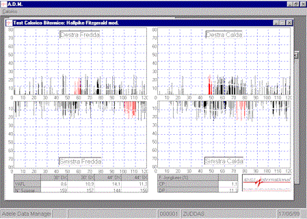 Visualizzazione risultati calorica.gif (34545 byte)
