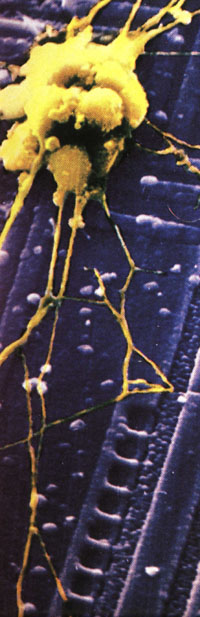 neuro on chip